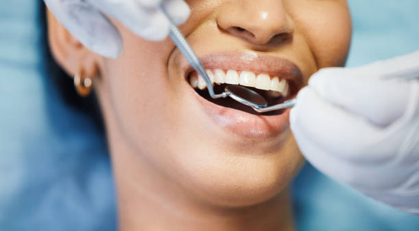 Best Broken or Cracked Tooth Emergency Dentist in Lawrenceburg, IN